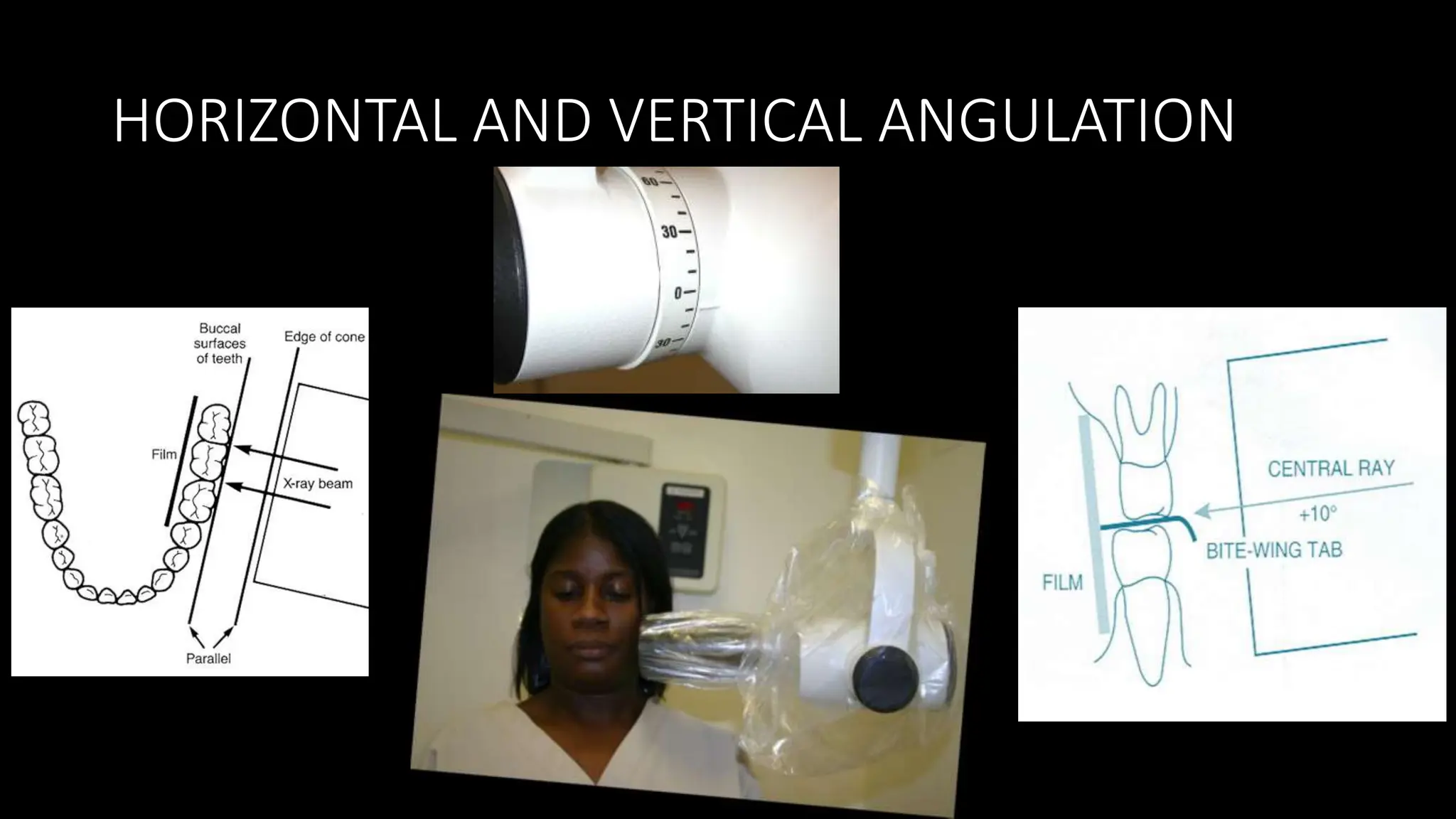 Dental radiology-BITEWING RADIOGRAPHY - Copy.pptx