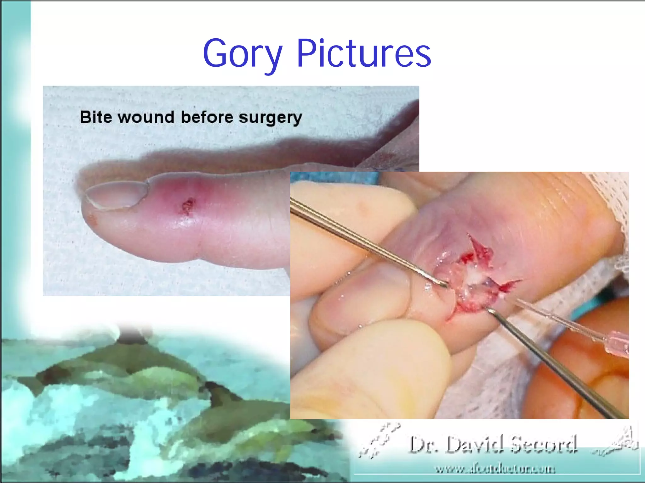 Bite Wound Lecture