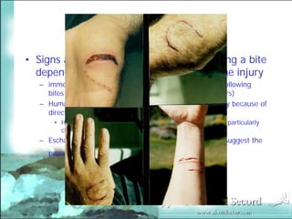 Bite Wound Lecture