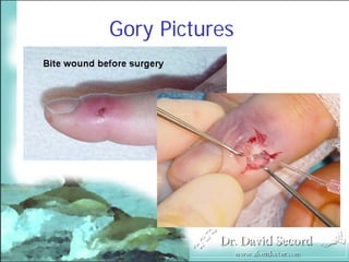 Bite Wound Lecture