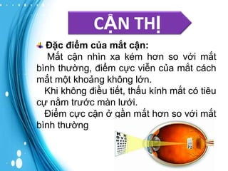 CẬN THỊ
Đặc điểm của mắt cận:
Mắt cận nhìn xa kém hơn so với mắt
bình thường, điểm cực viễn của mắt cách
mắt một khoảng không lớn.
Khi không điều tiết, thấu kính mắt có tiêu
cự nằm trước màn lưới.
Điểm cực cận ở gần mắt hơn so với mắt
bình thường

 
