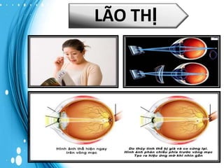 LÃO THỊ

 
