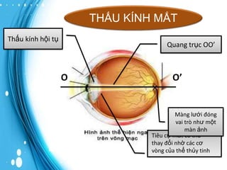 THẤU KÍNH MẮT
Thấu kính hội tụ

Quang trục OO’

O

O’

Màng lưới đóng
vai trò như một
màn ảnh
Tiêu cự mắt có thể
thay đổi nhờ các cơ
vòng của thể thủy tinh

 