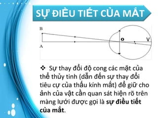 SỰ ĐIỀU TIẾT CỦA MẮT

 Sự thay đổi độ cong các mặt của
thể thủy tinh (dẫn đến sự thay đổi
tiêu cự của thấu kính mắt) để giữ cho
ảnh của vật cần quan sát hiện rõ trên
màng lưới được gọi là sự điều tiết
của mắt.

 