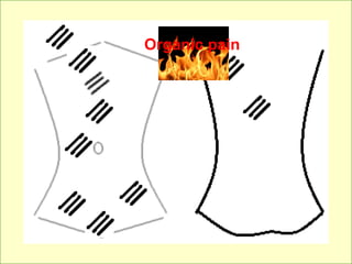 11
Organic pain
Organic pain
 