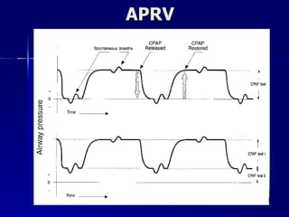 APRV 