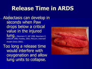 Release Time in ARDS Atelectasis can develop in seconds when Paw drops below a critical value in the injured lung.   (Neumann P, JAP 1998, Newmann P, AJRCCM 1998, Frawley, 2001; McCunn, Internat’l Anesth Clinics 2002).   Too long a release time would interfere with oxygenation and allow lung units to collapse. 