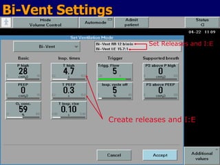Bi-Vent Settings Set Releases and I:E Create releases and I:E 