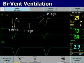 Bi-Vent Ventilation P High T High T PEEP 