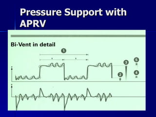 Pressure Support with APRV 