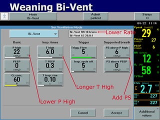 Weaning Bi-Vent Lower Rate Longer T High Lower P High Add PS 