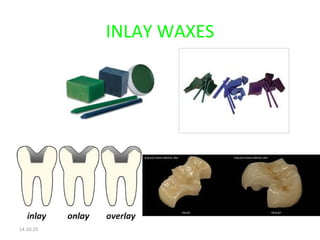 INLAY WAXES 
14.10.25 
 