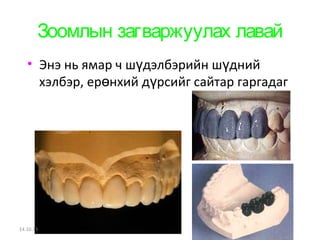 Зоомлын загваржуулах лавай 
• Энэ нь ямар ч шүдэлбэрийн шүдний 
хэлбэр, ерөнхий дүрсийг сайтар гаргадаг 
14.10.25 
 