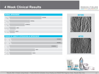 4 Week Clinical Results

                                                                                                           BEFORE




                                                                                                            AFTER




 Results After 4 Weeks Using Rodan + Fields MACRO Exfoliator Once Weekly and REDEFINE Regimen Daily. Results May Vary.   [8]
 