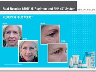 Real Results: REDEFINE Regimen and AMP MD™ System
RESULTS IN FOUR WEEKS*
BEFORE

BEFORE

AFTER
AFTER

*Unretouched photos. Results may vary.

[	
  10	
  ]	
  

 
