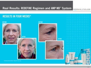Real Results: REDEFINE Regimen and AMP MD™ System
RESULTS IN FOUR WEEKS*
BEFORE

BEFORE

AFTER
AFTER

*Unretouched photos....