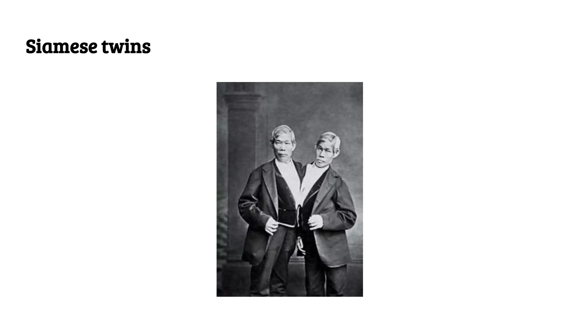 Siamese twins
 