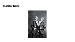 Siamese twins
 