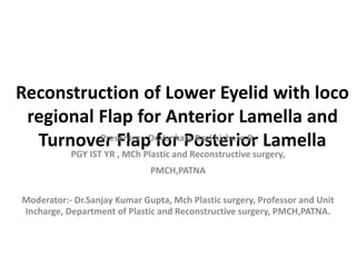 Reconstruction of Lower Eyelid with loco
regional Flap for Anterior Lamella and
Turnover Flap for Posterior Lamella
Presenter:- Dr.Venkata Ravi kishore.R,
PGY IST YR , MCh Plastic and Reconstructive surgery,
PMCH,PATNA
Moderator:- Dr.Sanjay Kumar Gupta, Mch Plastic surgery, Professor and Unit
Incharge, Department of Plastic and Reconstructive surgery, PMCH,PATNA.
 