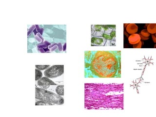 Prokaryotes vs. Eukaryotes 
 