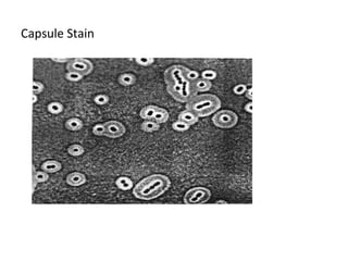 Capsule Stain 
 