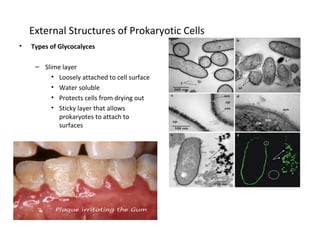External Structures of Prokaryotic Cells 
• Types of Glycocalyces 
– Slime layer 
• Loosely attached to cell surface 
• Water soluble 
• Protects cells from drying out 
• Sticky layer that allows 
prokaryotes to attach to 
surfaces 
 