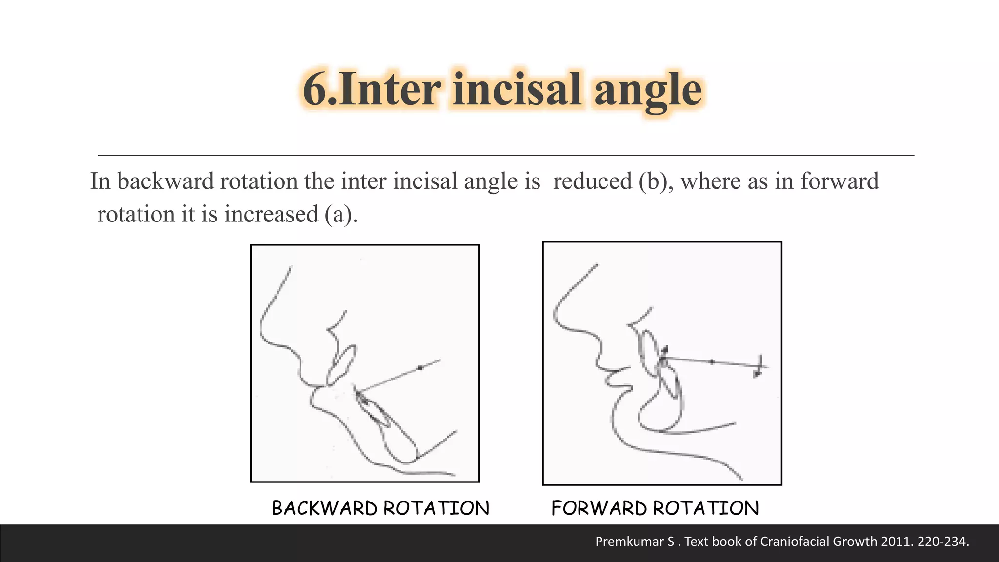 Bjork’s Concept of Jaw Rotation | PPTX