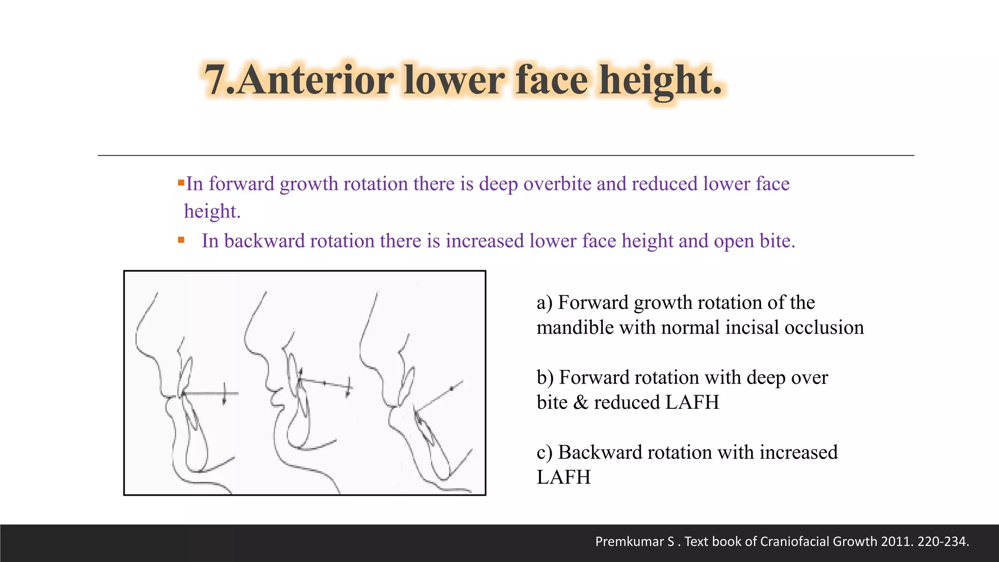 Bjork’s Concept of Jaw Rotation | PPTX