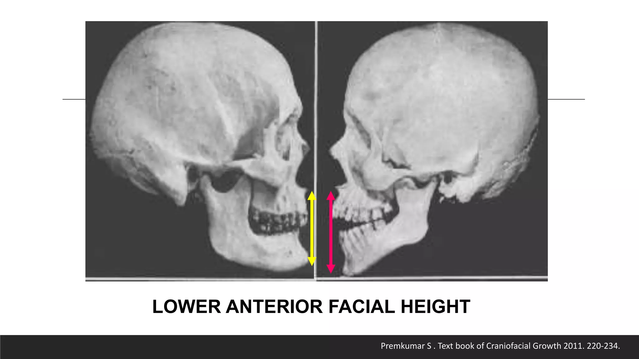 Bjork’s Concept of Jaw Rotation | PPTX