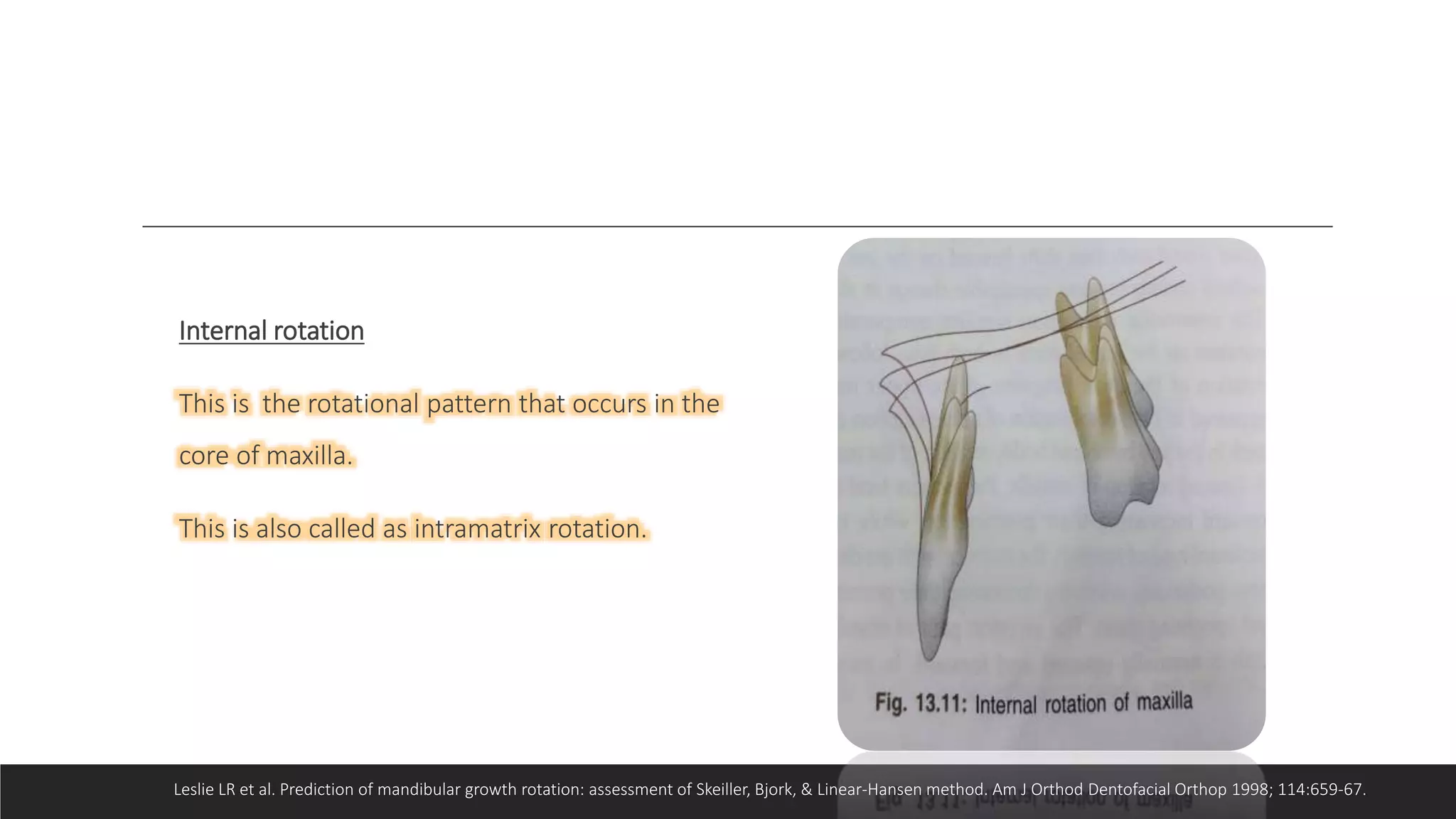 Bjork’s Concept of Jaw Rotation | PPTX