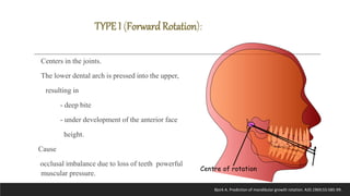 Bjork’s Concept of Jaw Rotation | PPTX