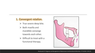 Bjork’s Concept of Jaw Rotation | PPTX