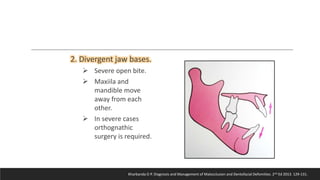 Bjork’s Concept of Jaw Rotation | PPTX
