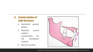 Bjork’s Concept of Jaw Rotation | PPTX