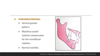 Bjork’s Concept of Jaw Rotation | PPTX