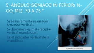 An lisis Cefalom trico De Bjork Y Jaraback PPTX an-lisis-cefalom-trico-de-bjork-y-jaraback-pptx