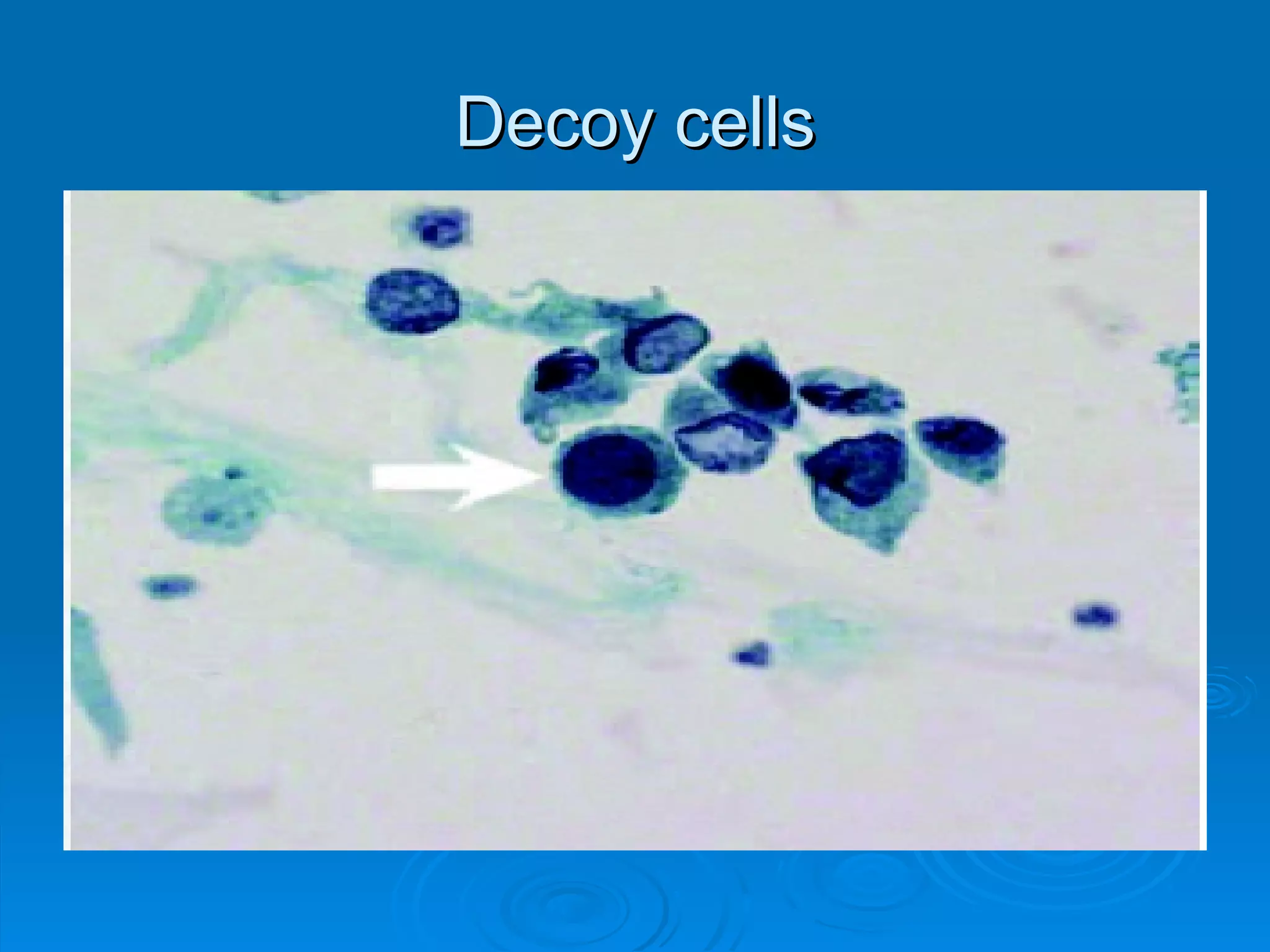Decoy cells 