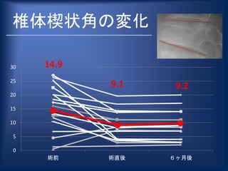 椎体楔状角の変化
0
5
10
15
20
25
30
術前 術直後 ６ヶ月後
14.9
9.1 9.2
 