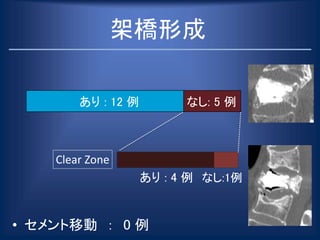 • セメント移動 ： 0 例
あり : 4 例 なし:1例
架橋形成
なし: 5 例あり : 12 例
Clear Zone
 