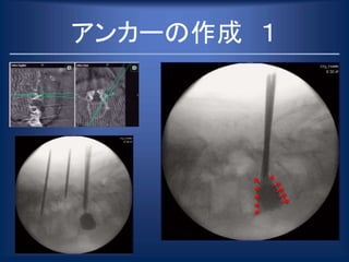 アンカーの作成 １
 