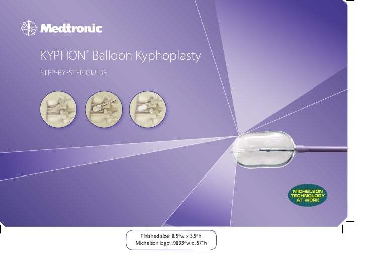 Balloon Kyphoplasty Step By Step Procedure Guide