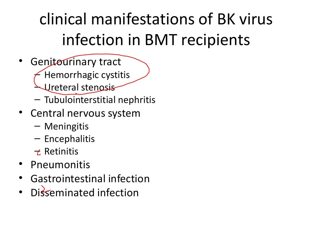 BK Virus infection in HSCT
