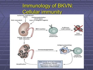 Immunology of BKVN:Immunology of BKVN:
Cellular immunityCellular immunity
 