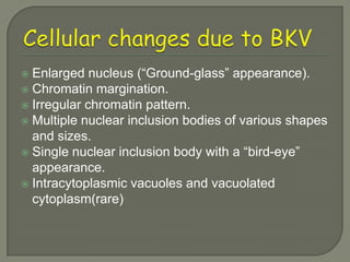  Enlarged nucleus (“Ground-glass” appearance).
 Chromatin margination.
 Irregular chromatin pattern.
 Multiple nuclear inclusion bodies of various shapes
  and sizes.
 Single nuclear inclusion body with a “bird-eye”
  appearance.
 Intracytoplasmic vacuoles and vacuolated
  cytoplasm(rare)
 