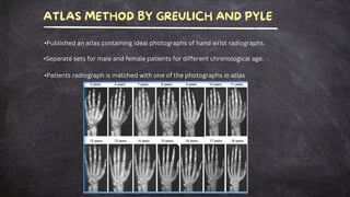 Assessment of skeletal age through various methods | PDF