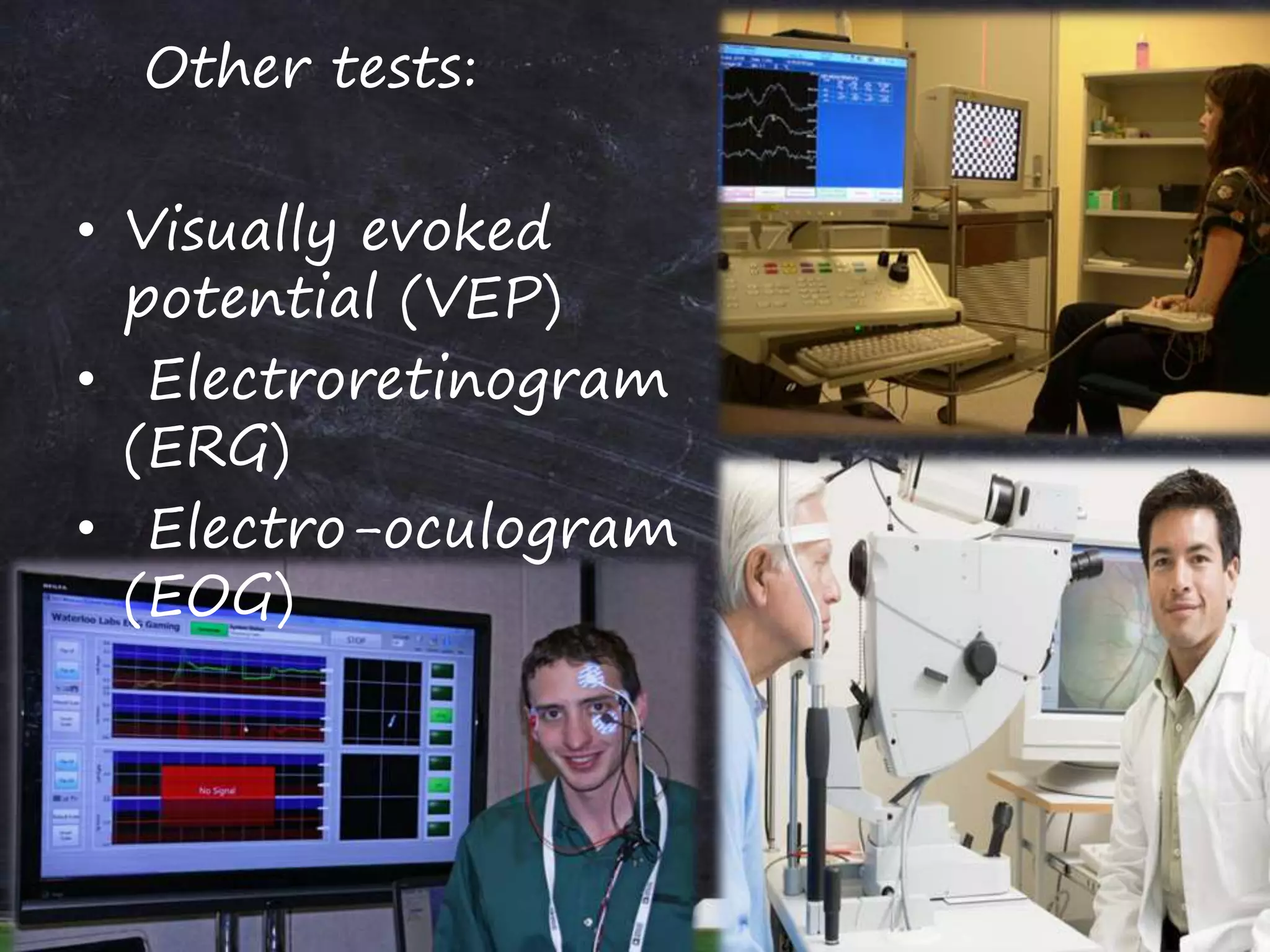 visual impairment | PPTX