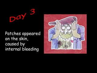 Patches appeared
on the skin,
caused by
internal bleeding
 
