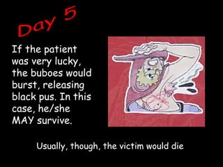 If the patient
was very lucky,
the buboes would
burst, releasing
black pus. In this
case, he/she
MAY survive.
Usually, though, the victim would die
 