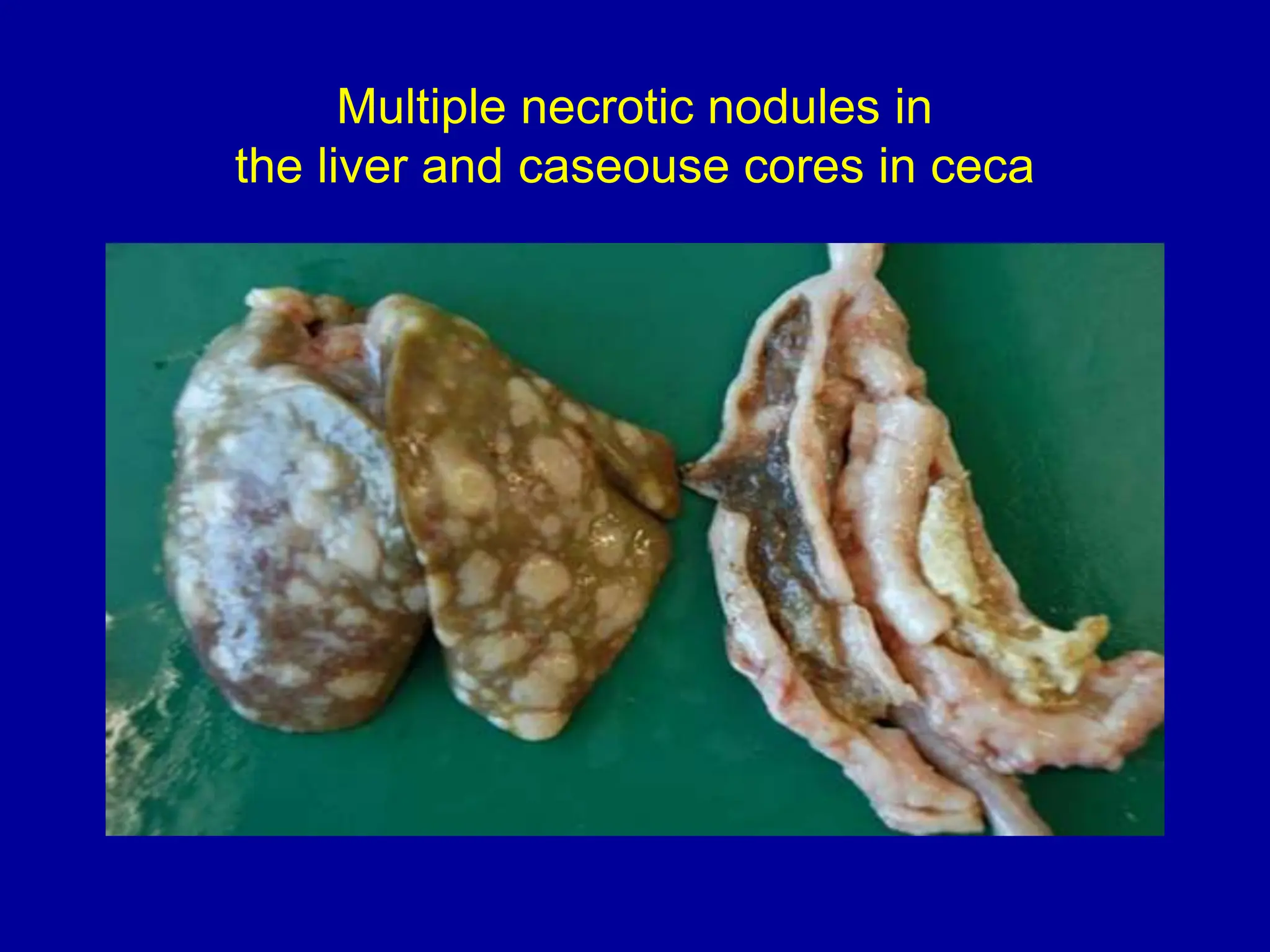 Multiple necrotic nodules in
the liver and caseouse cores in ceca
 