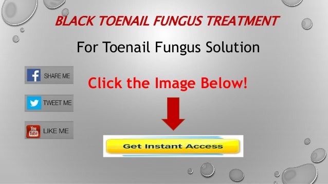 Black Toenail Fungus Treatment